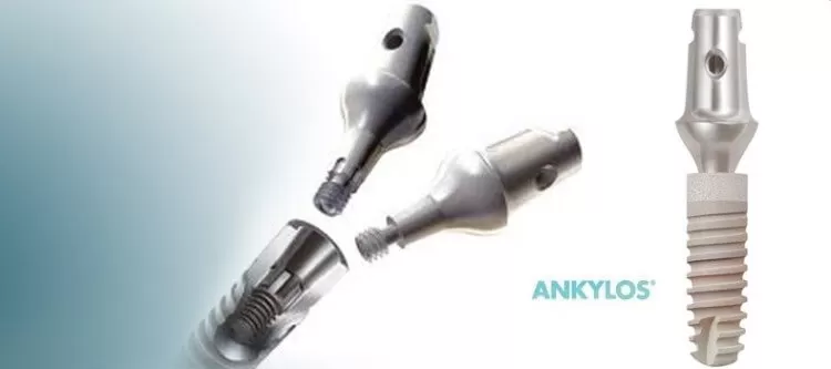 ANKYLOS изготавливаются с применением технологии TissueCare — конусного соединения имплантата и абатмента